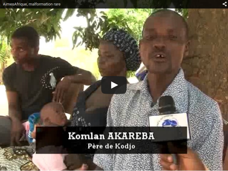 Cas de Maladie Grave Mais Curable (MGMC). Appel de fonds ( En vidéo)